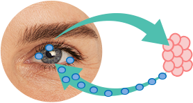 Chronic Dry Eye Syndrome - Inflammation and Irritation
